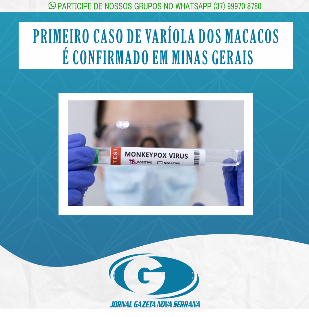 PRIMEIRO CASO DE VARÍOLA DOS MACACOS É CONFIRMADO EM MINAS GERAIS